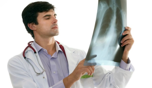 Особенности проведения рентгена легких после перенесенной пневмонии